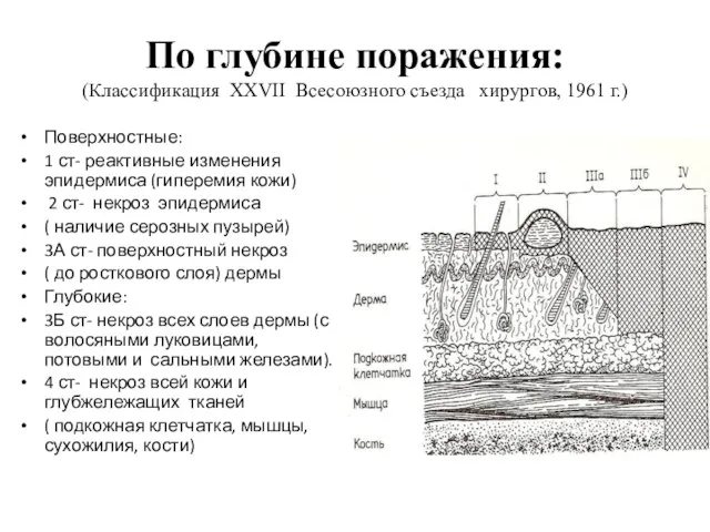 По глубине поражения: (Классификация XXVII Всесоюзного съезда хирургов, 1961 г.) Поверхностные: