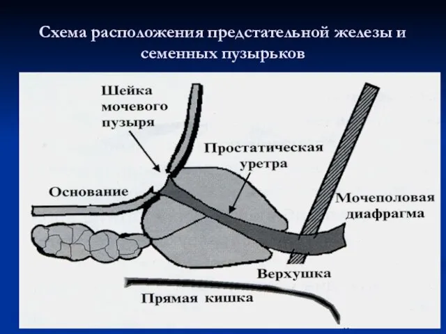 Схема расположения предстательной железы и семенных пузырьков