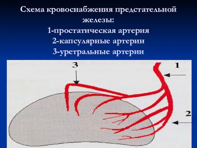 Схема кровоснабжения предстательной железы: 1-простатическая артерия 2-капсулярные артерии 3-уретральные артерии