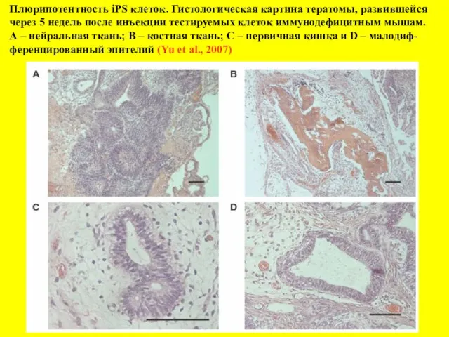 Плюрипотентность iPS клеток. Гистологическая картина тератомы, развившейся через 5 недель после