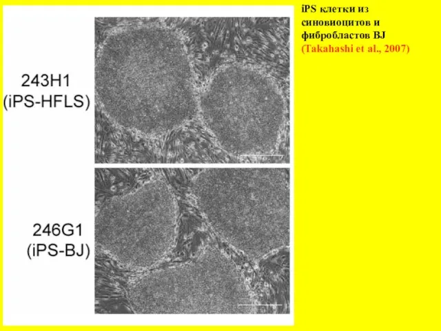 iPS клетки из синовиоцитов и фибробластов BJ (Takahashi et al., 2007)