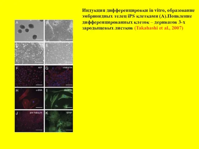 Индукция дифференцировки in vitro, образование эмбриоидных телец iPS клетками (А).Появление дифференцированных