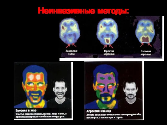 Неинвазивные методы: 4. Термография