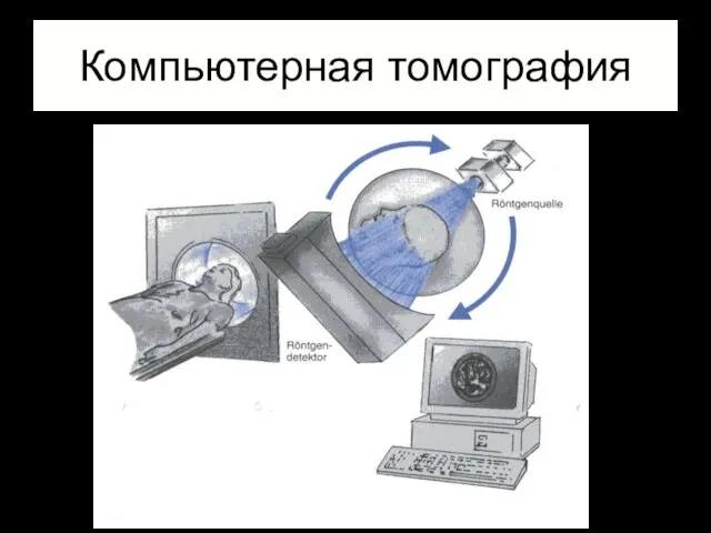 Компьютерная томография