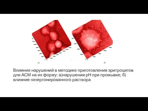 Влияние нарушений в методике приготовления эритроцитов для АСМ на их форму: