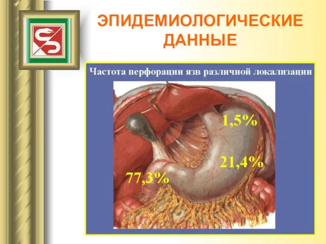 ЭПИДЕМИОЛОГИЧЕСКИЕ ДАННЫЕ