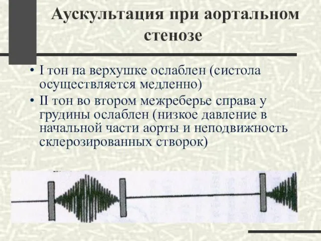 Аускультация при аортальном стенозе I тон на верхушке ослаблен (систола осуществляется