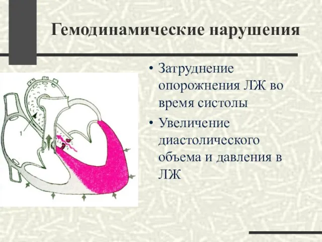 Гемодинамические нарушения Затруднение опорожнения ЛЖ во время систолы Увеличение диастолического объема и давления в ЛЖ