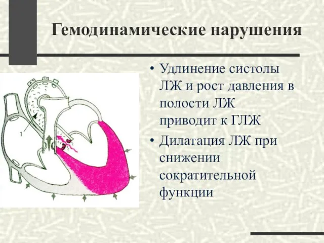 Гемодинамические нарушения Удлинение систолы ЛЖ и рост давления в полости ЛЖ