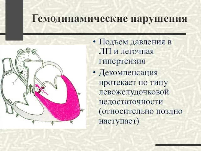 Гемодинамические нарушения Подъем давления в ЛП и легочная гипертензия Декомпенсация протекает