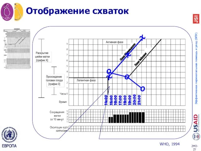 Отображение схваток 14:00 15:00 16:00 17:00 18:00 19:00 20:00 21:00 O