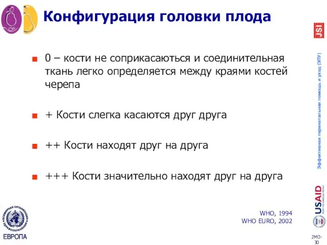 Конфигурация головки плода 0 – кости не соприкасаються и соединительная ткань