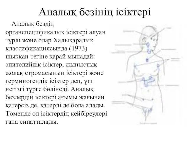 Аналық безінің ісіктері Аналық бездің органспецификалық ісіктері алуан түрлі және олар