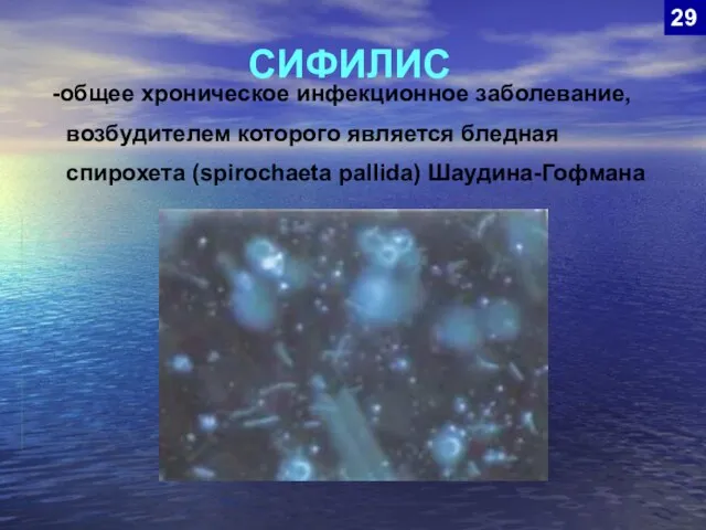 общее хроническое инфекционное заболевание, возбудителем которого является бледная спирохета (spirochaeta pallida) Шаудина-Гофмана СИФИЛИС 29
