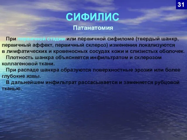 СИФИЛИС 31 Патанатомия При первичной стадии или первичной сифиломе (твердый шанкр,