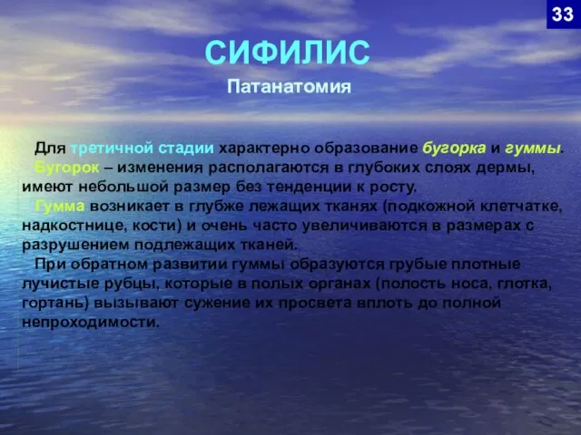 СИФИЛИС 33 Патанатомия Для третичной стадии характерно образование бугорка и гуммы.