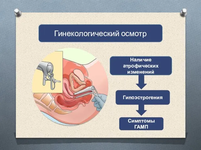 Гинекологический осмотр Наличие атрофических изменений Гипоэстрогения Симптомы ГАМП