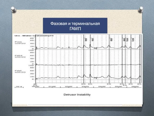 Фазовая и терминальная ГАМП