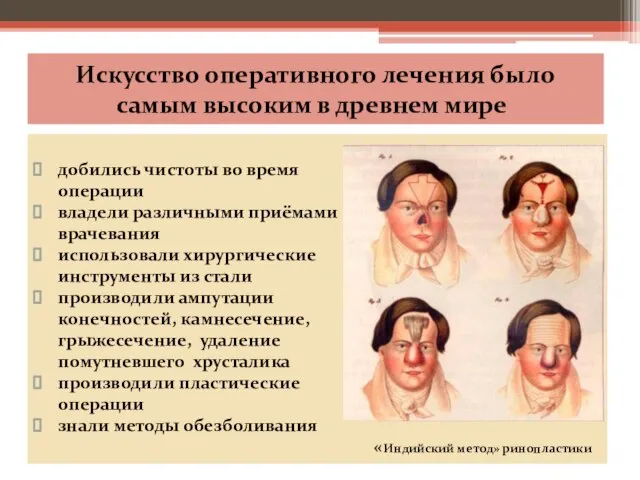 Искусство оперативного лечения было самым высоким в древнем мире добились чистоты