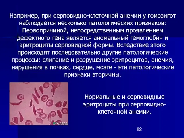 Например, при серповидно-клеточной анемии у гомозигот наблюдается несколько патологических признаков: Первопричиной,