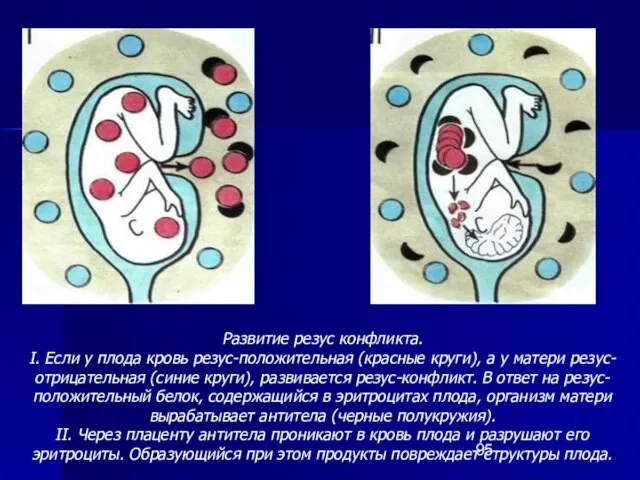 Развитие резус конфликта. I. Если у плода кровь резус-положительная (красные круги),