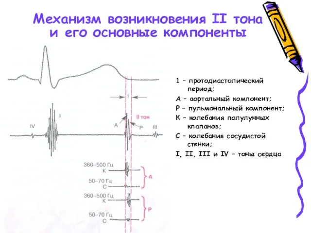 Механизм возникновения II тона и его основные компоненты 1 – протодиастолический