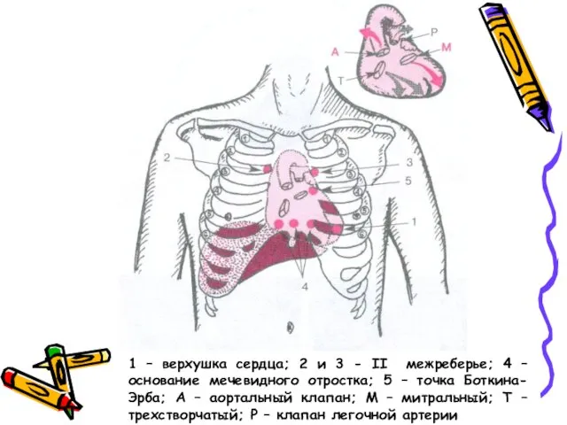 1 – верхушка сердца; 2 и 3 - II межреберье; 4