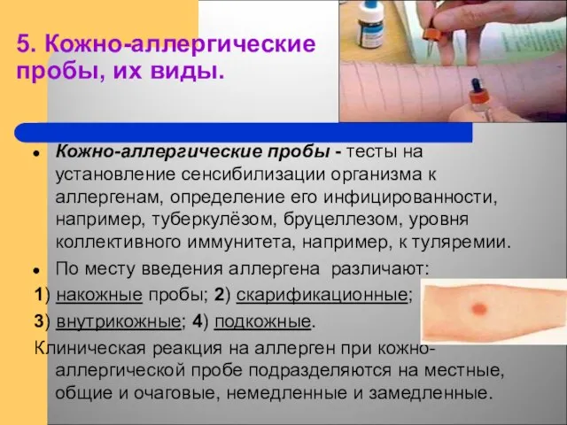 5. Кожно-аллергические пробы, их виды. Кожно-аллергические пробы - тесты на установление