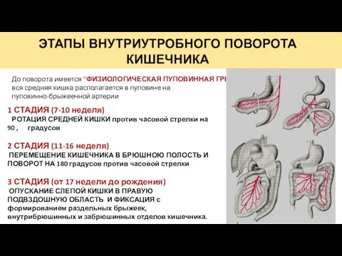 ЭТАПЫ ВНУТРИУТРОБНОГО ПОВОРОТА КИШЕЧНИКА 1 СТАДИЯ (7-10 неделя) РОТАЦИЯ СРЕДНЕЙ КИШКИ