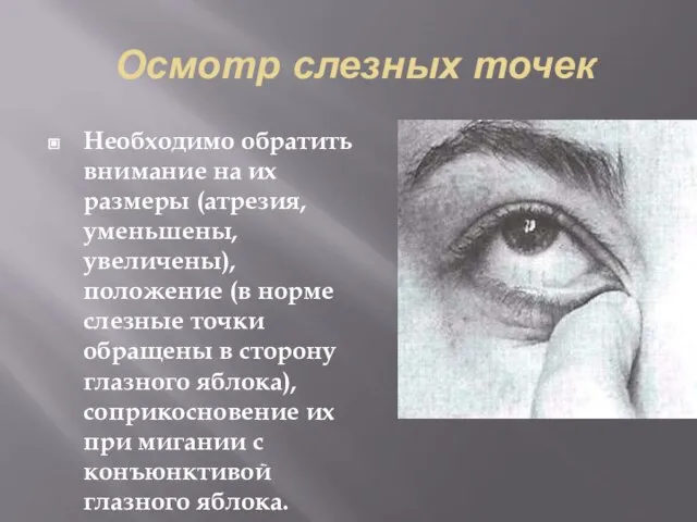 Осмотр слезных точек Необходимо обратить внимание на их размеры (атрезия, уменьшены,