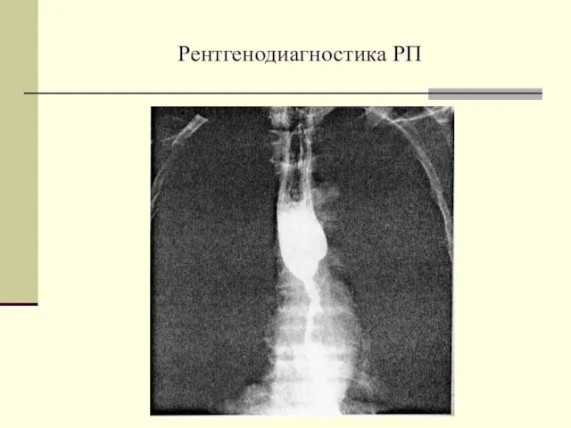 Рентгенодиагностика РП