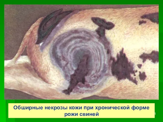 Обширные некрозы кожи при хронической форме рожи свиней