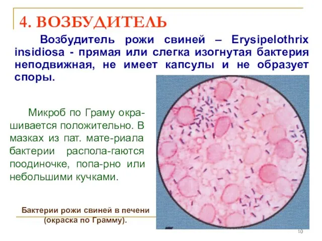 4. ВОЗБУДИТЕЛЬ Возбудитель рожи свиней – Erysipelothrix insidiosa - прямая или