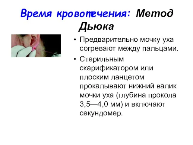 Время кровотечения: Метод Дьюка Предварительно мочку уха согревают между пальцами. Стерильным