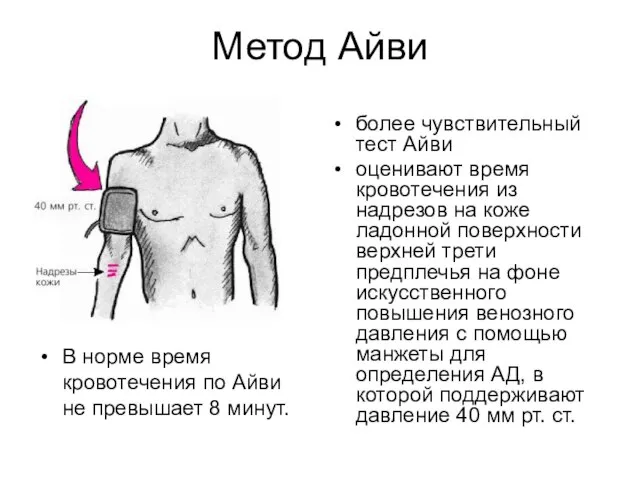 Метод Айви В норме время кровотечения по Айви не превышает 8