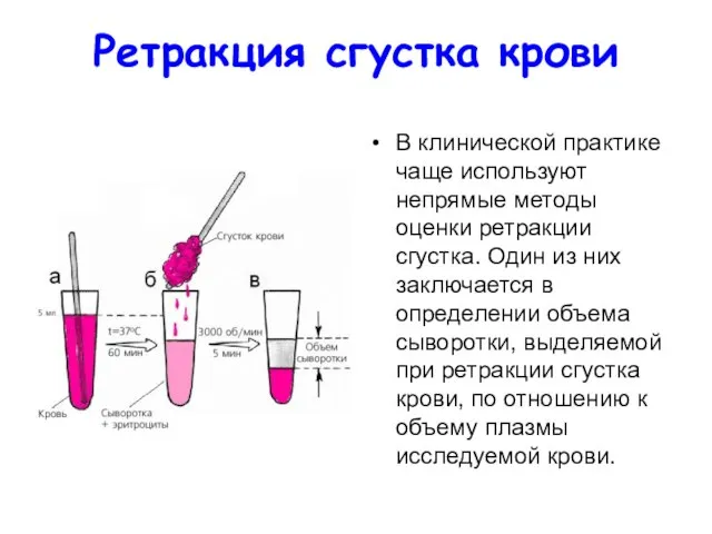 Ретракция сгустка крови В клинической практике чаще используют непрямые методы оценки