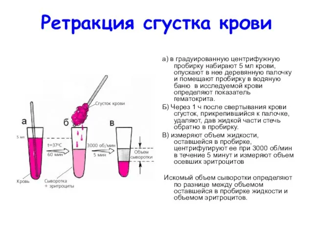 Ретракция сгустка крови а) в градуированную центрифужную пробирку набирают 5 мл