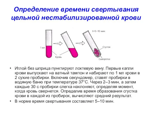 Определение времени свертывания цельной нестабилизированной крови Иглой без шприца пунктируют локтевую