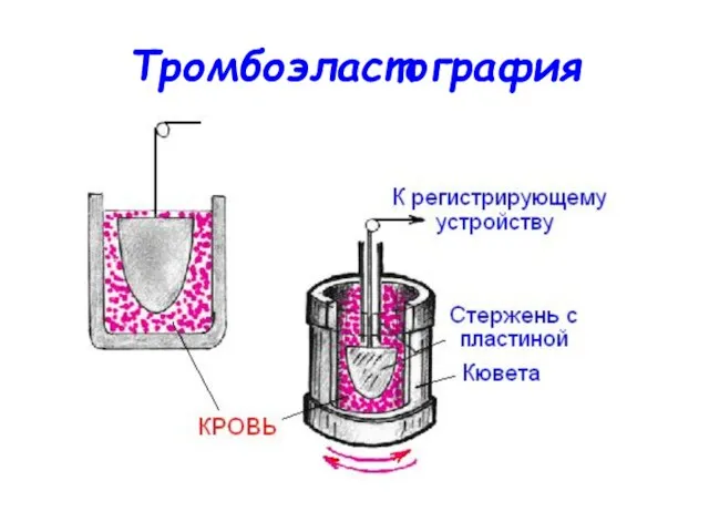 Тромбоэластография