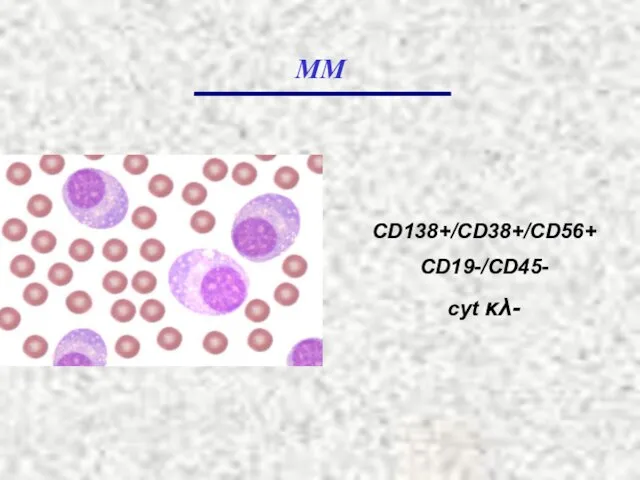 ММ CD138+/CD38+/CD56+ CD19-/CD45- cyt κλ-