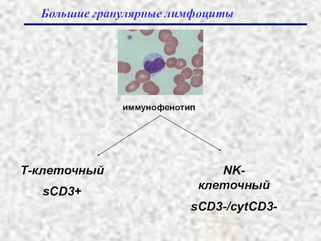 Большие гранулярные лимфоциты иммунофенотип Т-клеточный sCD3+ NK-клеточный sCD3-/cytCD3-