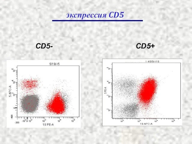 CD5+ CD5- экспрессия CD5