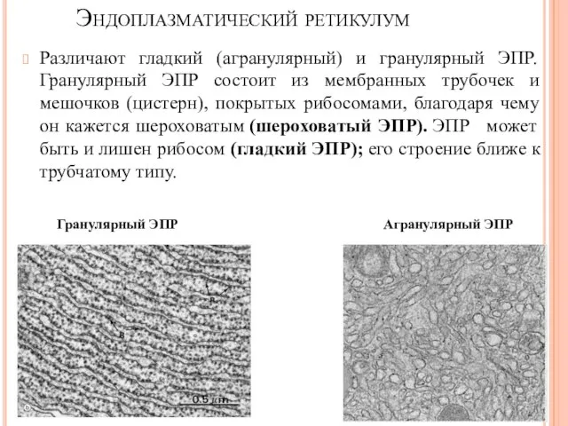 Различают гладкий (агранулярный) и гранулярный ЭПР. Гранулярный ЭПР состоит из мембранных