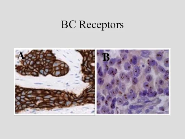 BC Receptors