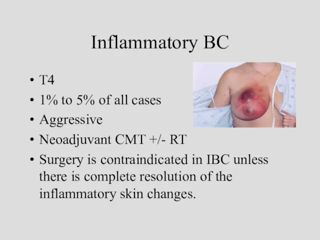 Inflammatory BC T4 1% to 5% of all cases Aggressive Neoadjuvant