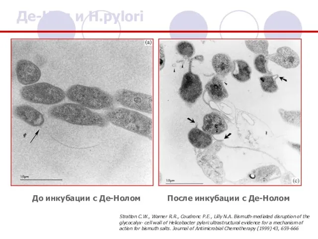 До инкубации с Де-Нолом Де-Нол и Н.pylori После инкубации с Де-Нолом