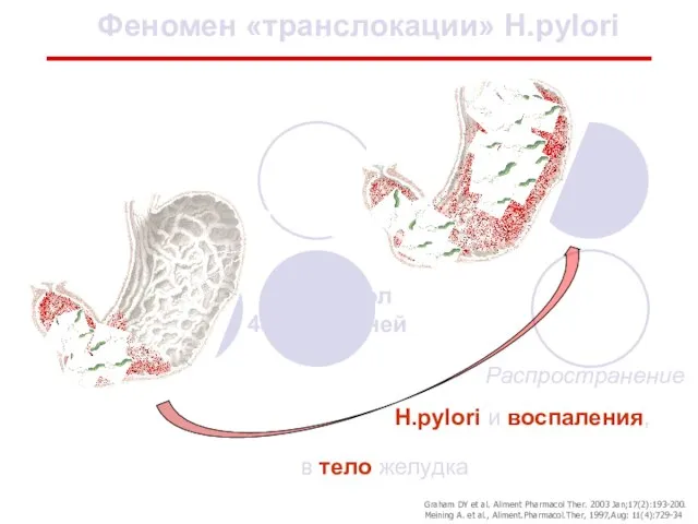 в тело желудка Распространение Н.pylori и воспаления, Феномен «транслокации» Н.pylori Омепразол