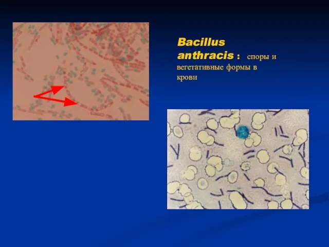 Bacillus anthracis : споры и вегетативные формы в крови