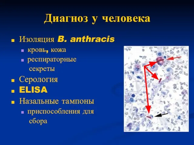 Диагноз у человека Изоляция B. anthracis кровь, кожа респираторные секреты Серология