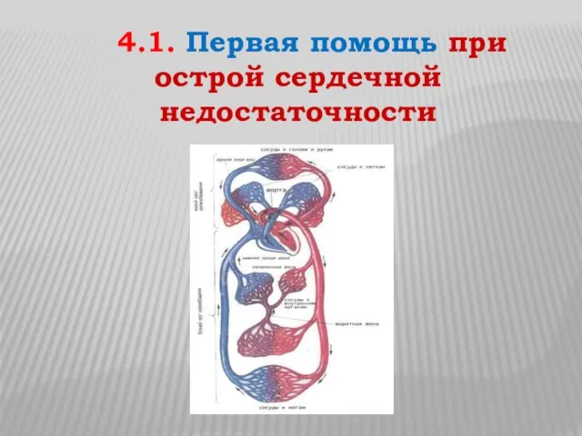 4.1. Первая помощь при острой сердечной недостаточности